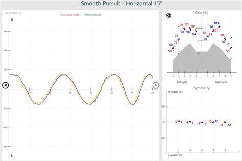 smooth pursuit test interpretation